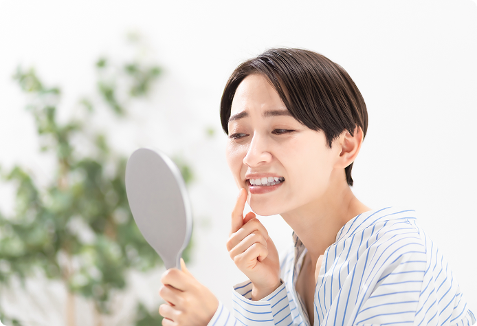 歯石