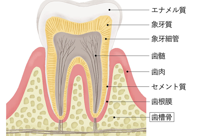 歯周病